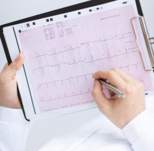 ECG
