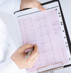 ECG