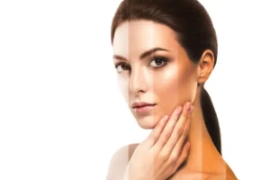 Dermatologist-Hyderabad-Asmara-Multi-Speciality-Clinic